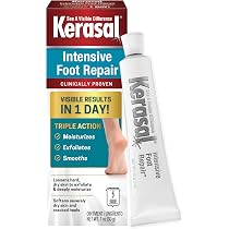 Amazon.com : Kerasal Intensive Foot Repair, Skin Healing Ointment ...