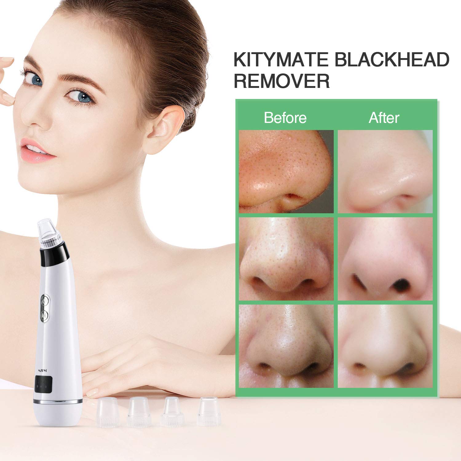 Blackhead Remover Pore Vacuum, Electric Blackhead Vacuum Suction Tool Set Skin Facial Pore Cleaner, Acne Comedo Eliminator Blackhead Extractor Device for Women\'s Skin Care with 5 Multi-Functional Probe