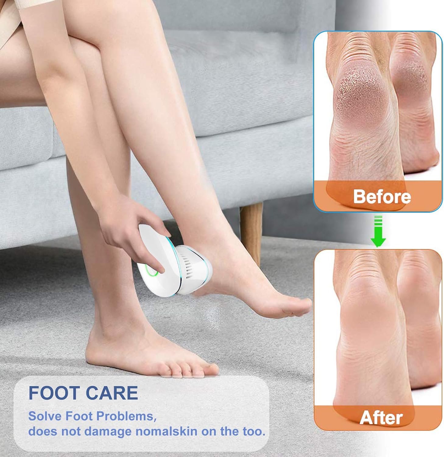 Electric Foot Callus Remover kit-Electric Foot File Pedicure Tools Built-in Vacuum,Electric vacum Foot Grinder,Professional Pedicure Tools Feet Care for Dead Hard Cracked Dry Skin (Blue) - Image 4