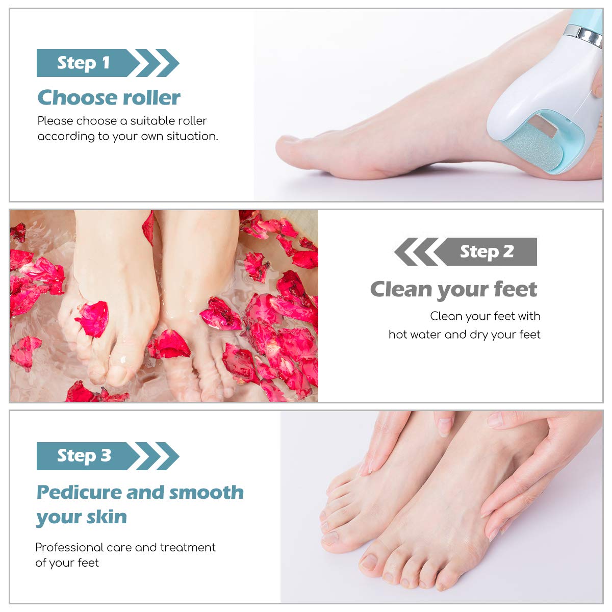 Mondeer Electronic Callus Remover, Blu-ray Disinfection Pedicure Tool, Foot Massage, 3 Rollers Included(Fine Grinding Roller/Rough Grinding Roller/ Massage Roller), Unisex, A Free Foot File Included.