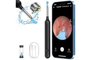 Ear Wax Removal Kit Tool with Camera, Oxbird 1080P Wireless Earwax Camera Ear Camera Otoscope Cleaner Smart Ear Cleaner with Camera and Light for iPhone, Ipad & Android Smart Phones, Black