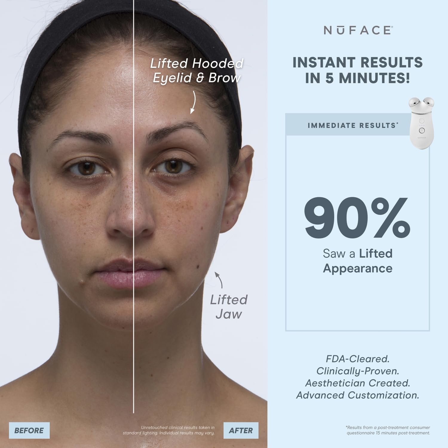 NuFACE TRINITY+ Effective Lip & Eye Attachment for Microcurrent Facial Device - FDA Cleared At Home Eye Lift & Smile Lines Treatment to Tighten & Tone Hard-to-Reach Areas Around Mouth and Eyes
