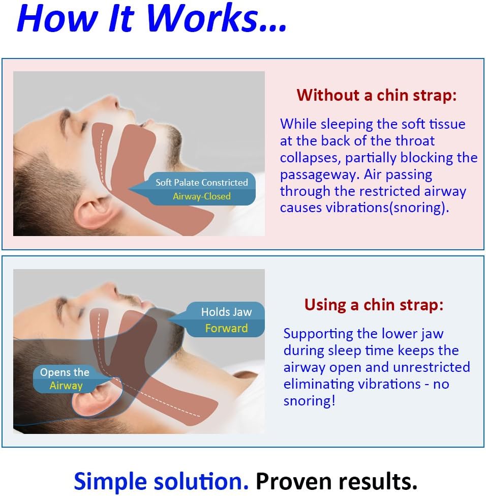 Anti Snoring Chin Strap - Most Effective Snoring Solution and Anti Snoring Devices - Snoring Chin Strap - Stop Snoring Sleep Aid for Men and Women [Upgraded Version]: Health & Personal Care