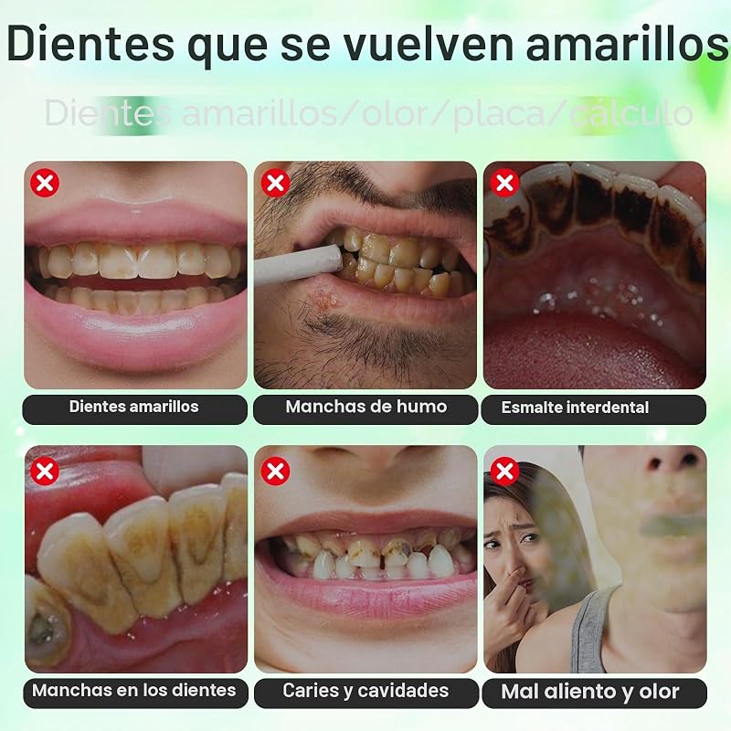 Kit Profissional de Branqueamento Dentário, Kit de Branqueamento Caseiro, Gel Branqueador 10*, Branqueamento Dentário Indolor e Seguro para Esmalte, Remoção Eficaz de Manchas de Café/Chá