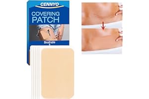 CENNYO Tattoo-Cover-Up Waterproof-Sweatproof-Sticker-Patch Ultra-Thin-Patch-for-Tattoo-Scar-and-Birthmarks Tattoo-Cover-Up-Tape-for-Light-Skin-Tone, 6 Count (Pack of 1)