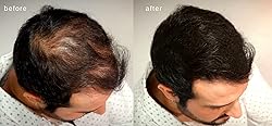 MAXX PRO-SERIES Volumizing Hair Fibers with real