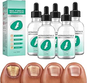 Kerassentials Toenail Fungus Treatment Oil, Kerassentials