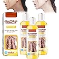 Acanthosis nigricans peeling oil,Full Body Exfoliation Peeling Oil For All Skin Type (1 PCS)