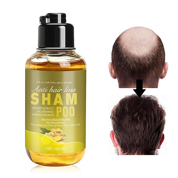 GINGER SHAMPOO, GINGER SHAMPOO FOR HAIR GROWTH, GINGER ANTI-FALL SHAMPOO, GINGER ANTI-HAIR LOSS HAIR SHAMPOO, GINGER HAIR REGROWTH SHAMPOO FOR THICKER, STRONGER, SMOOTHER, AND MORE GLOSSY HAIR