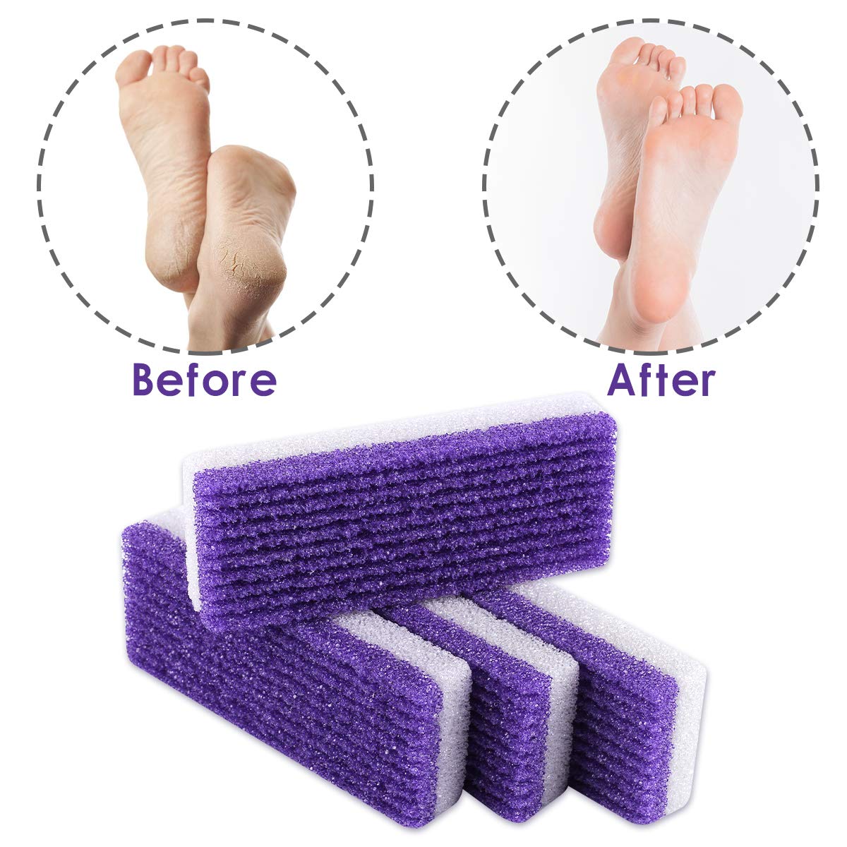 7Pc Foot Pumice Stone for Feet Hard Skin Callus Remover, 2 in 1 Foot Pumice Stone, Double Sided Hard Skin Callus Remover, Dead Skin Scrubber Pedicure Tools, Hard Skin Callus Remover for Feet and Hands: Beauty