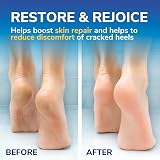 Dr. Scholl's Cracked Heel Cream Repair K+ 60ml Dry Skin Moisturising Keratin view 4