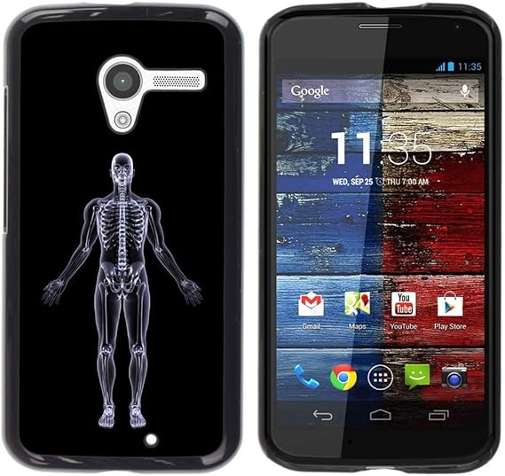 Amazon.com: GIFT CHOICE / Slim Hard Protective Case SmartPhone Shell