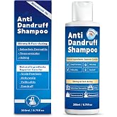 Ketoconazole Shampoo 1% Anti Dandruff Shampoo for Itchy Flaky Scalp | 1% Ketoconazole shampoo helps control dandruff, flaking, scaling, and itching while gently cleansing the scalp