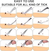 EasyULT 3Pcs Tick Remover Tool Set Stainless Steel Tick Hook Tweezers Kit view 6