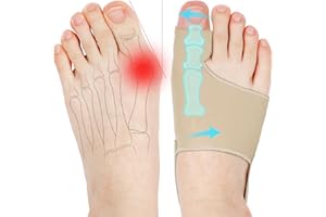 KTSAY 2 Pcs Bunion Corrector for Women & Men, Bunion Socks Toe Corrector Comfortable & Breathable for Day/Night Support, Hallux Valgus Pain Relief Non-Slip Big Toe Straightener (Beige, Medium)