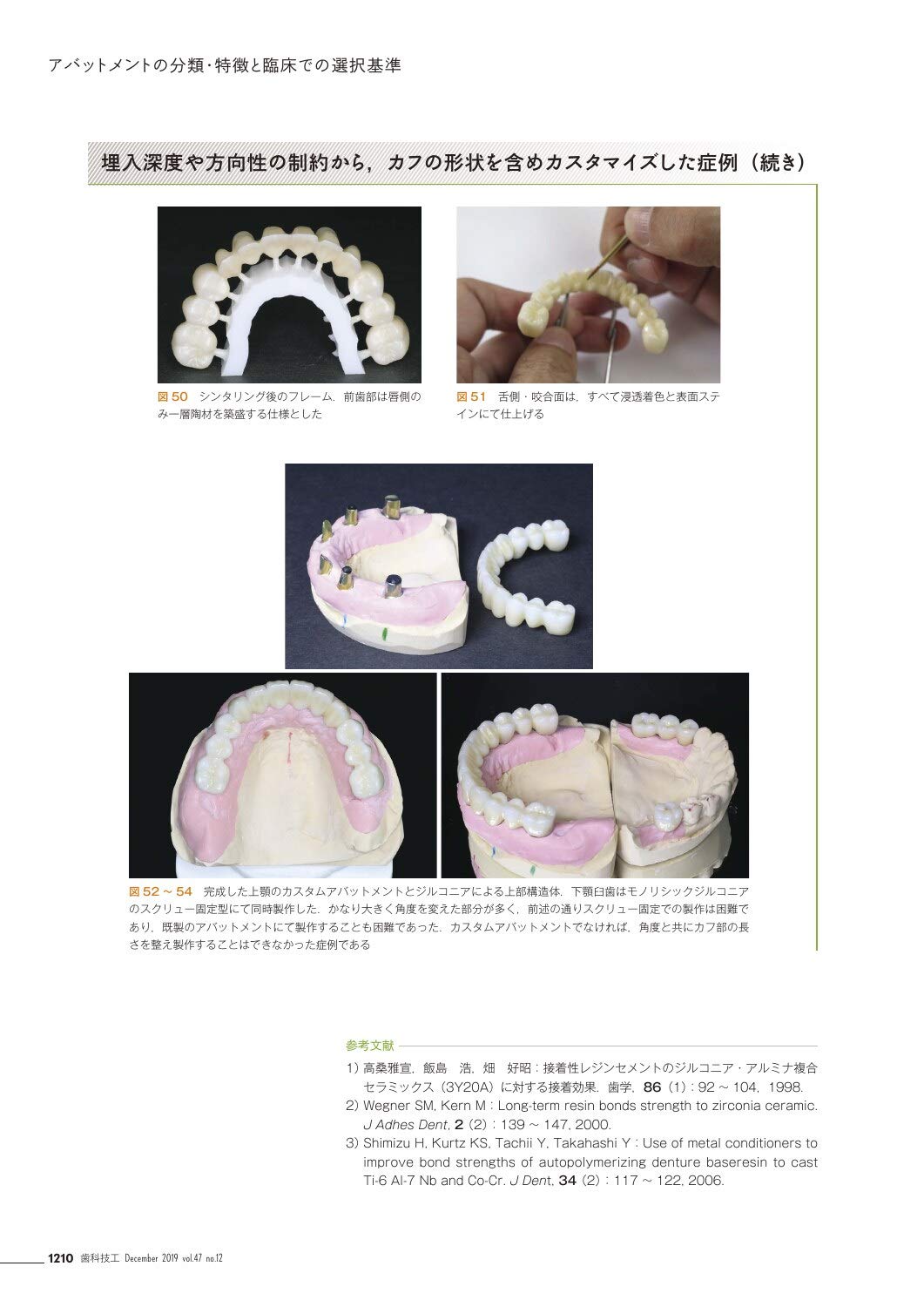 歯科技工 歯科用3dプリンターのインハウスの可能性を考察する Bego Varseo Sを臨床応用したインハウス3dプリンターの実力 19年12月号 47巻12号 雑誌 本 通販 Amazon