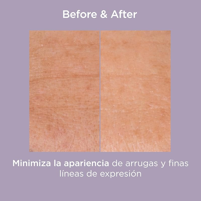 Isdinceutics Glicoisdin 25 Gel Exfoliante con Ácido Glicólico, Acción Exfoliante para Una Piel Renovada, 25 g