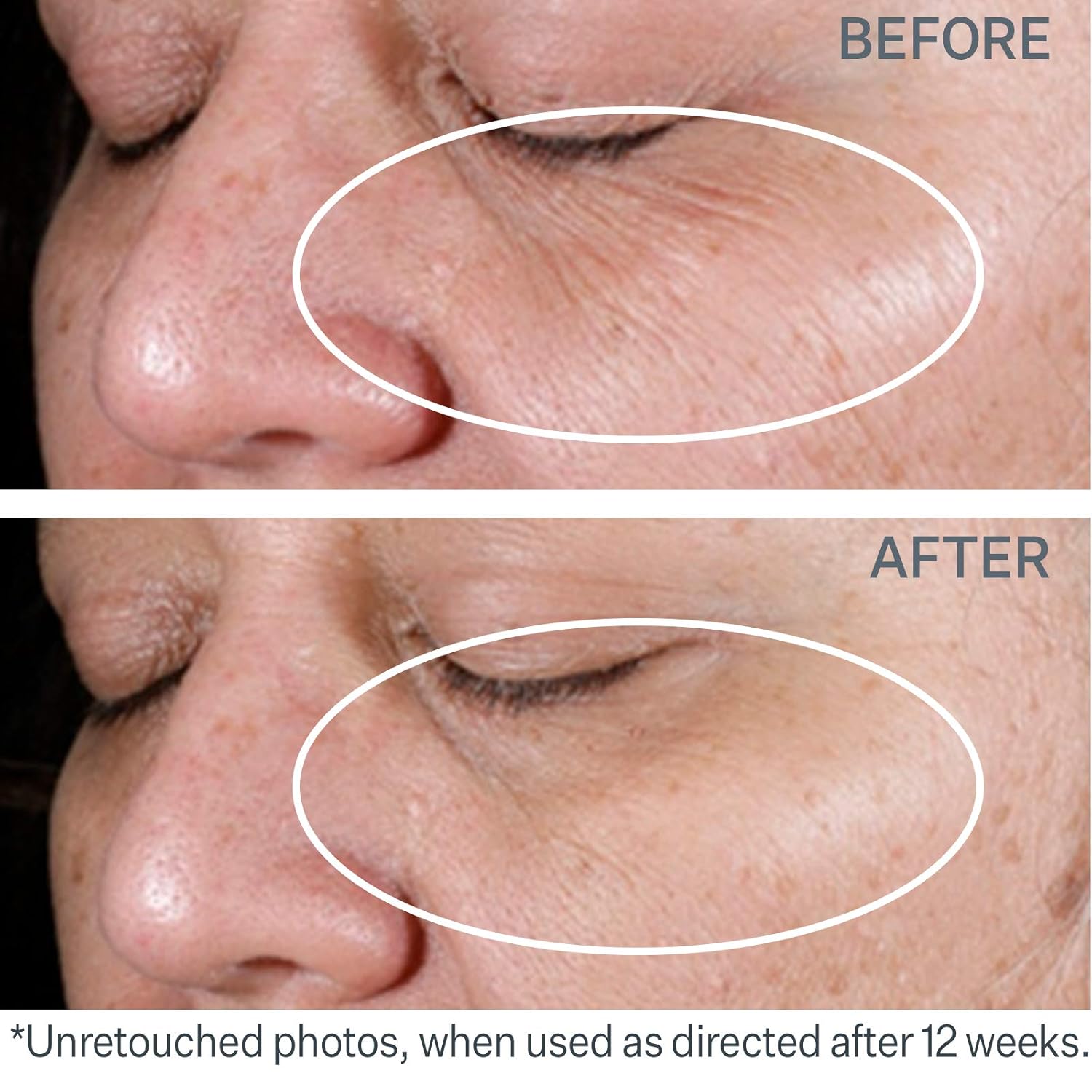 strivectin wrinkle cream