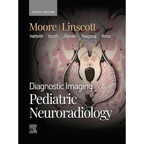 Amazon.com: ExpertDDx: Brain and Spine E-Book eBook : Salzman MD