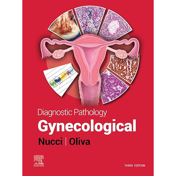 Amazon.com: Diagnostic Histopathology of Tumors E-Book: Expert