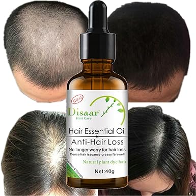  Hair Growth Vitamins Unisex Thinning Hair
