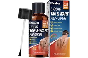 YUEJOIKL Wart Remover, Maximum Strength Skin Tag Remover Liquid with 12% Salicylic Acid, Fast Acting Wart Removal for Common & Plantar Warts, Natural Formula for All Skin Types-K05