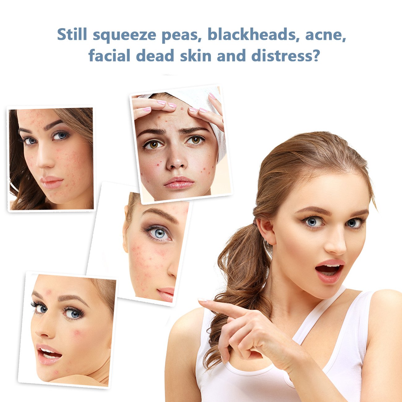 Professional Blackhead & Splinter Remover Tools Easily Cure Pimples Whiteheads Comedones Acne Zit Ingrown Hairs and Facial Impurities Surgical Stainless Steel with Alcohol Prep Pad