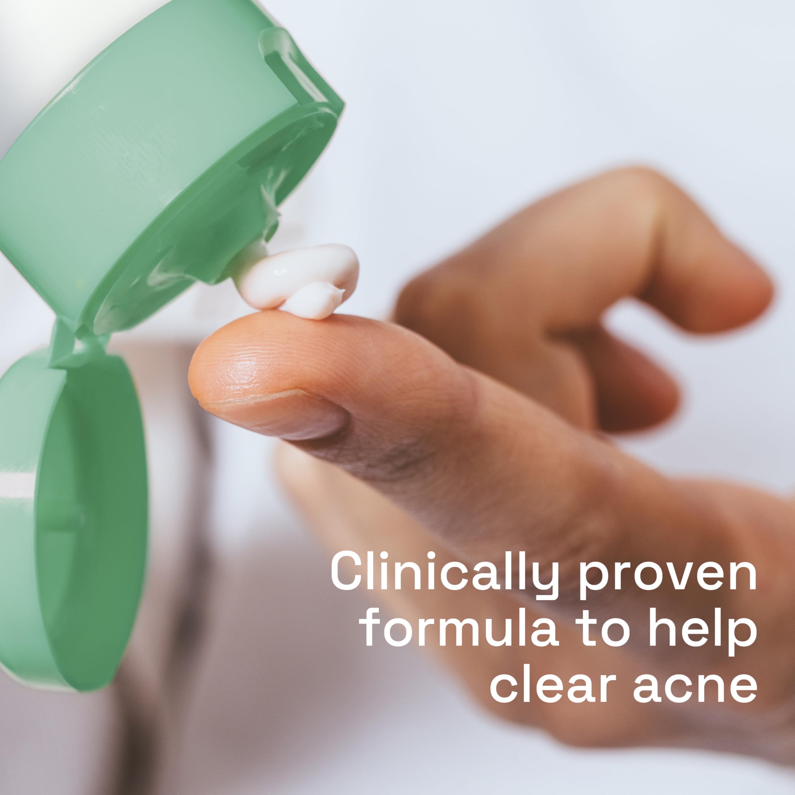 Cetaphil Acne Face Wash, Gentle Clear Clarifying Acne Cream Cleanser with 2% Salicylic Acid, Deep Cleans & Treats Acne Prone Skin, Skin Care for Sensitive Skin, 4.2oz