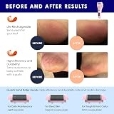PEFOOK Electric Foot File Callus Remover Waterproof Rechargeable 3 Heads 2 view 3