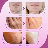 UREA LABS 10% Urea Cream Salicylic Acid Aloe Jojoba Moisturizer 150ml view 6