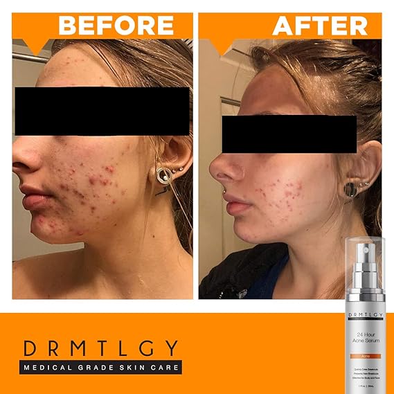 drmtlgy dark spot corrector