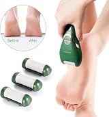 ShoRan Electric Foot File Feet Hard Skin Remover Roller White view 5