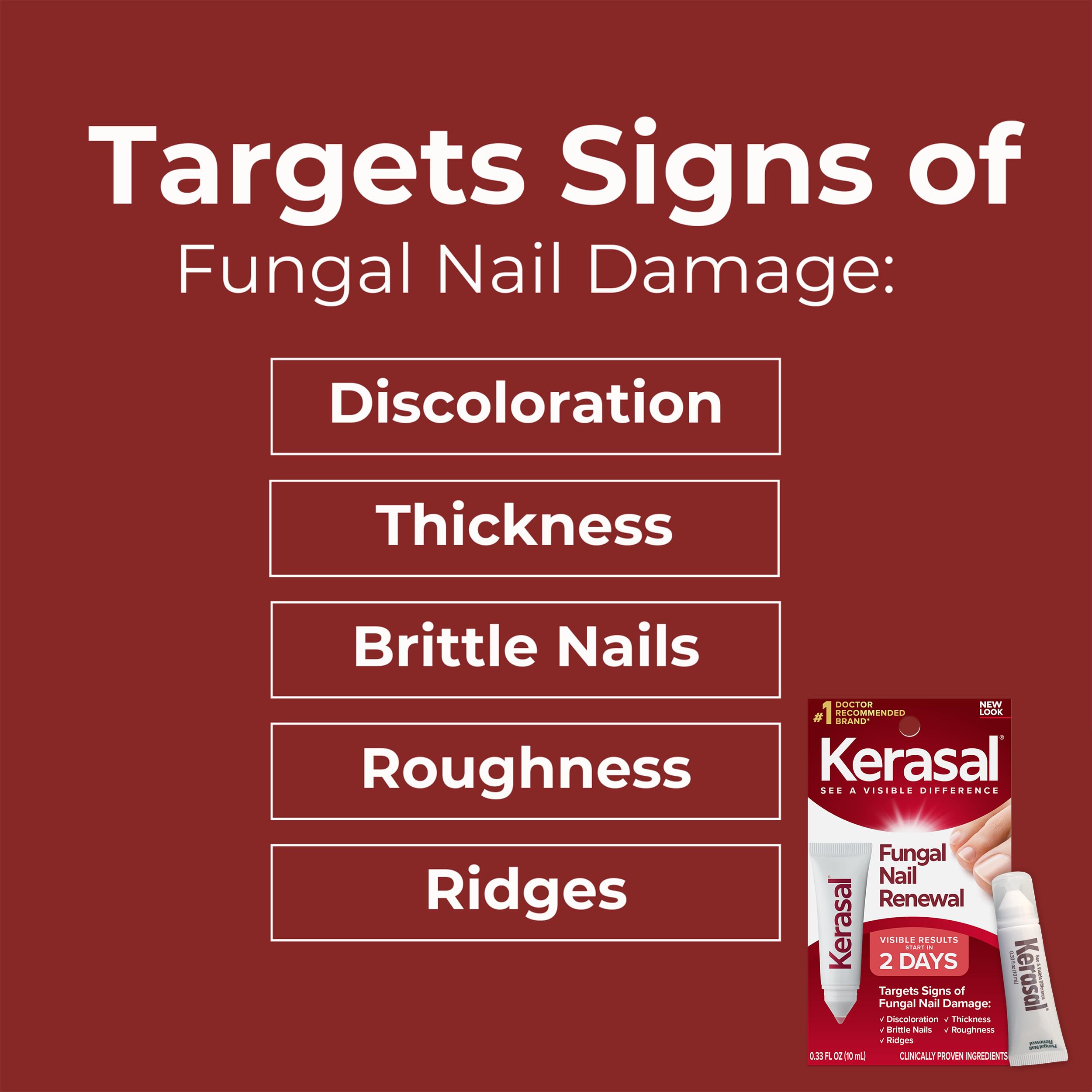 Kerasal Nail Fungus Extra Strength | Restorative Nail Repair for Damaged Nails, 0.33 fl oz (Packaging May Vary)