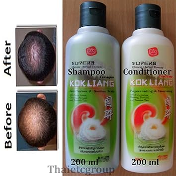 Amazon Com Kokliang Kok Liang Anti Hair Loss Anti Dandruff
