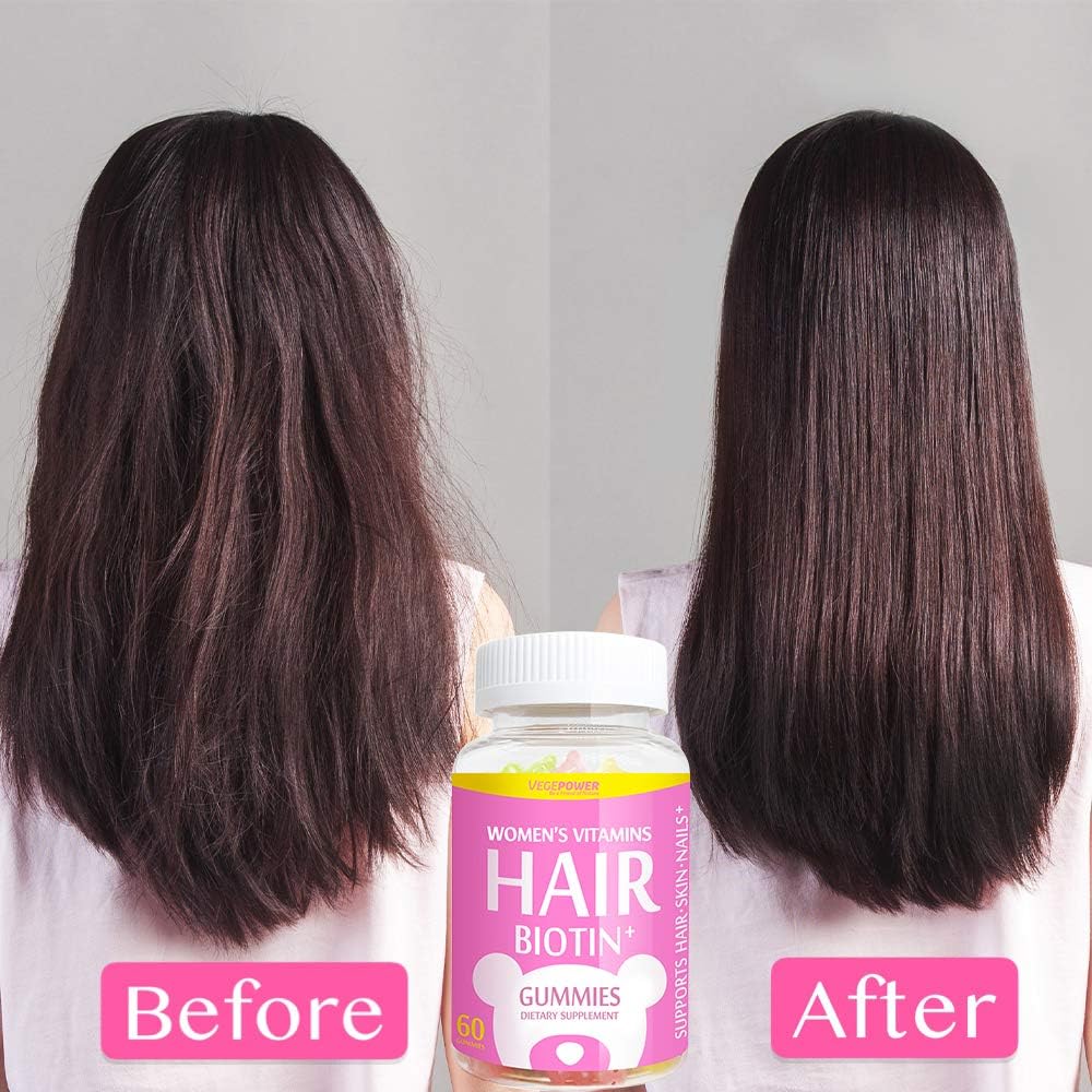 Vegepower Biotin Vitamin Gummies 10000 mcg for Fast Hair Growth, Skin and Nails-Collagen Booster Plus Multivitamin C & E, Vegan, Pectin-Based, Non-GMO, for Women Men-3 Natural Fruit Flavors: Health & Personal Care