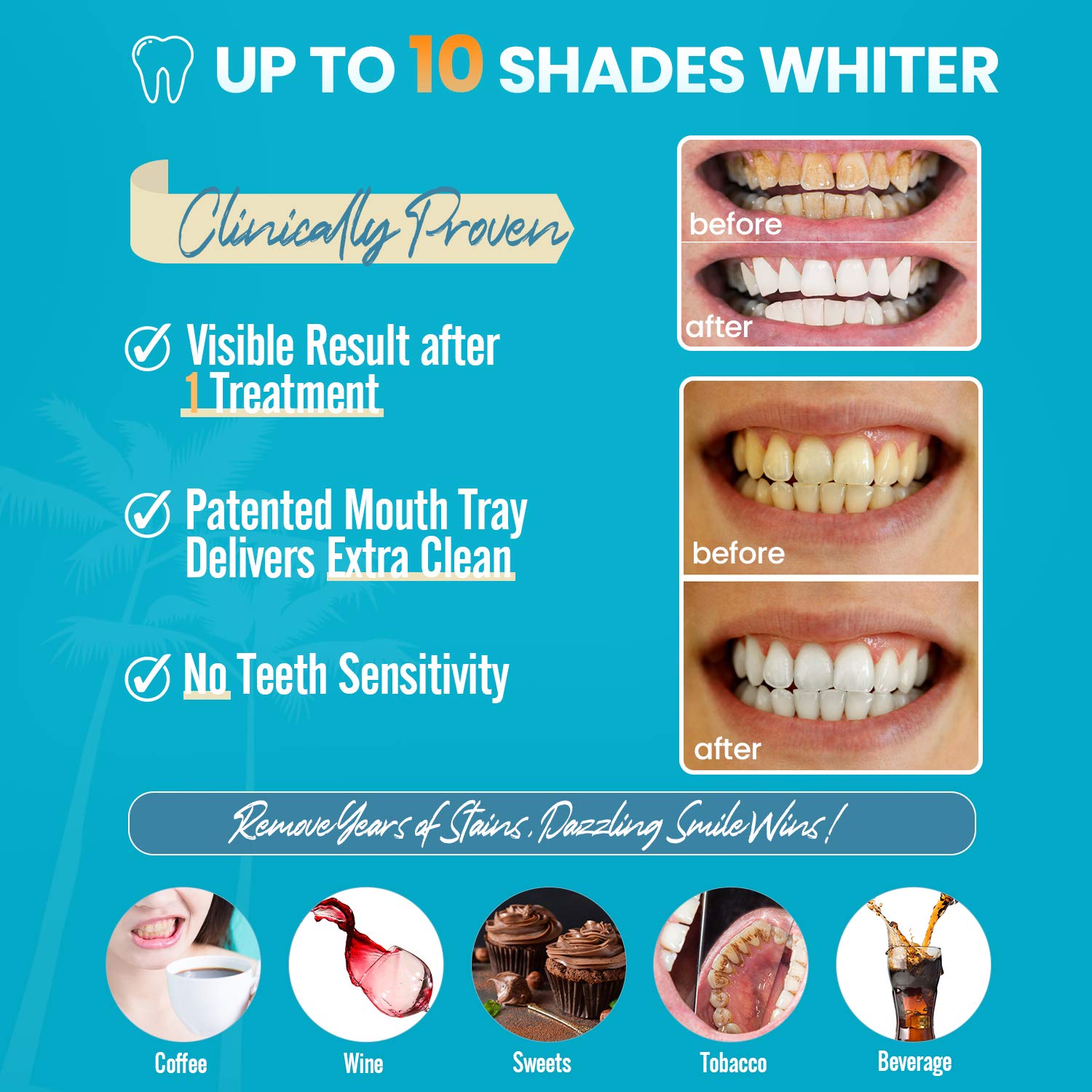Neitra Teeth Whitening Kit with LED Light, (4Pcs) 3ml 30% Carbamide Peroxide Teeth Whitening Gel, Teeth Whitening Result in 1 Use, 5X LED Accelerator, No Sensitivity Teeth Whitener(White Pro Series): Beauty