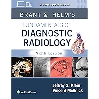 Fundamentals of Body MRI (Fundamentals of Radiology