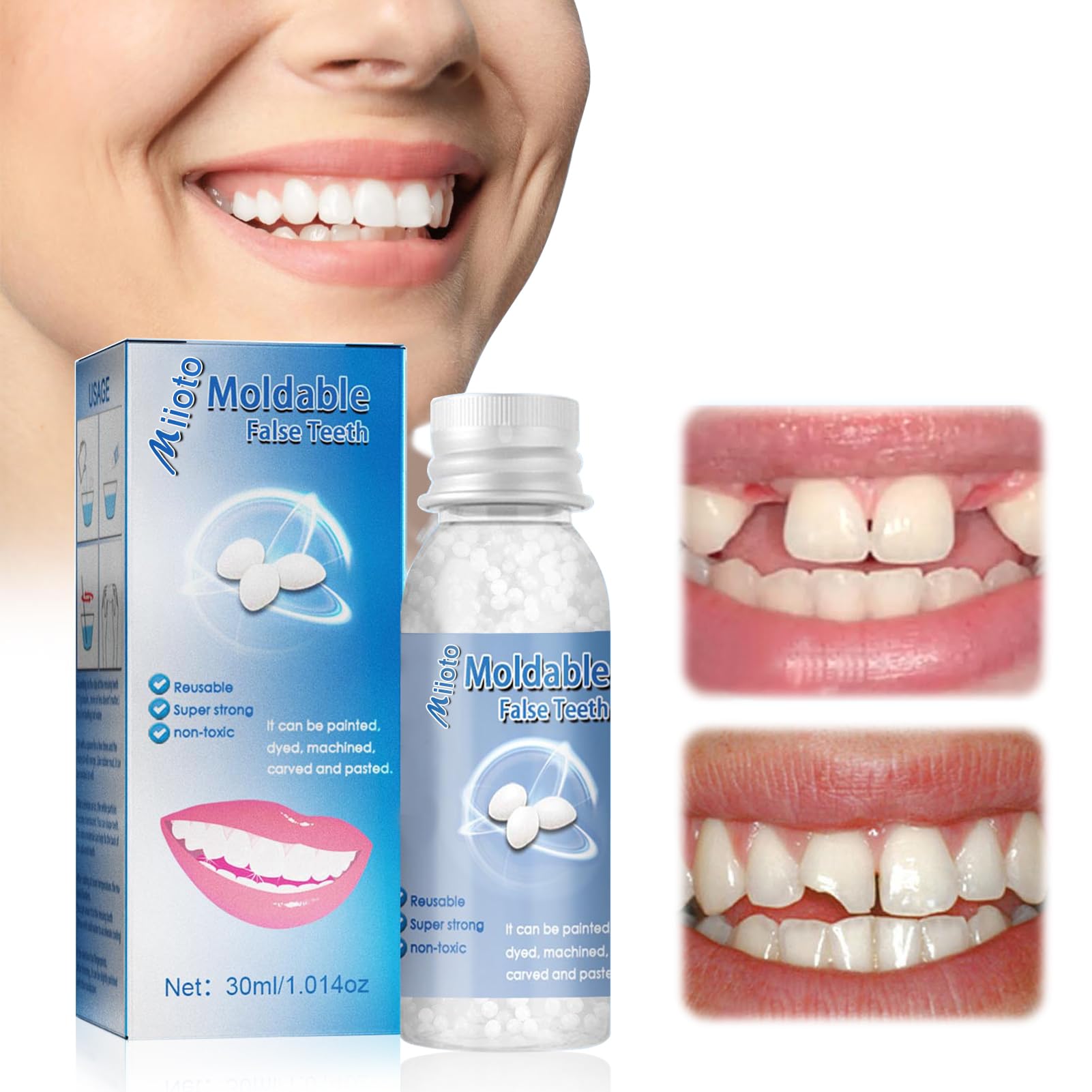 Ganbaro Moldable False Teeth Repair Granules, DIY Temporary Tooth Repair Beads, Temporary Fix for Missing and Broken Teeth, 30ml (BLUE)