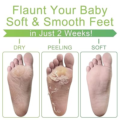Buy Foot Peel Mask Lavender Foot Peeling Mask 2 Pack For Cracked Heels Dead Skin Calluses Removes Repairs Rough Heels Dry Toe Skin Make Your Feet Baby Soft Get A Smooth Skin Baby Soft Touch