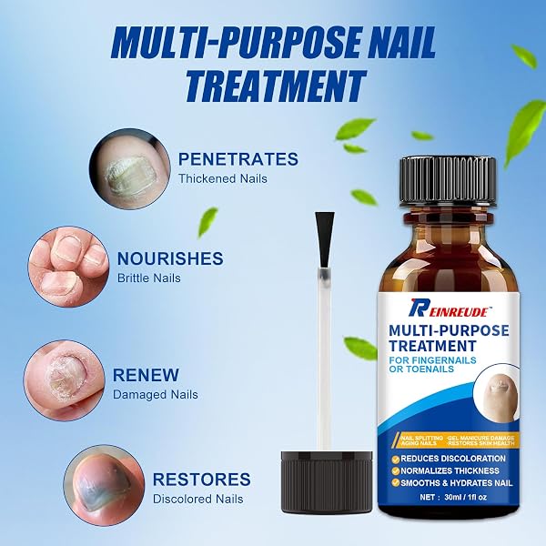TOENAIL FUNGUS TREATMENT EXTRA STRENGTH 30ML, WUNILA MULTI-PURPOSE NAIL REPAIR SOLUTION FOR DISCOLORED DAMAGED NAILS, PLANT OIL FOR FUNGAL NAIL FUNGUS TREATMENT FAST ACTING, TOE NAIL FUNGUS TREATMENT