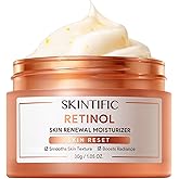 Retinol Skin Renewal Moisturizer, Retinol Cream for Face, Blemish Care, Oil Control & Pore Minimizing, Lightweight, Fragrance-Free, Night Cream for All Skin Types from Age 20+, 1fl.oz / 30g