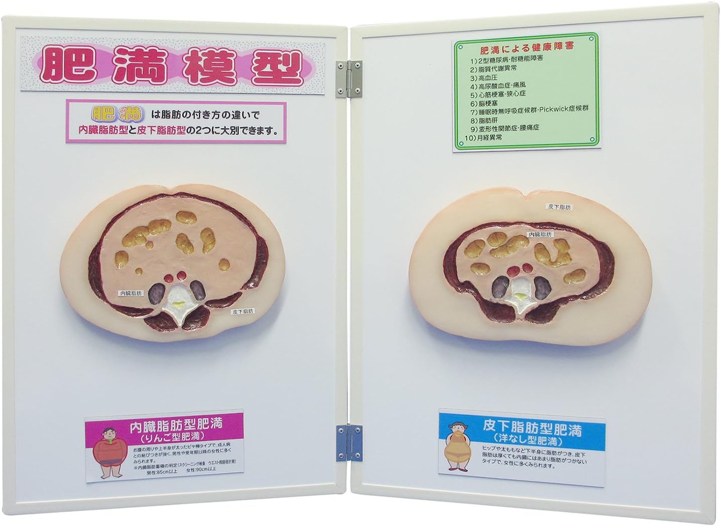 Amazon 肥満模型 内臓脂肪型 皮下脂肪型 肥満症 ダイエット 健康指導教材 生物 動物 人体 おもちゃ
