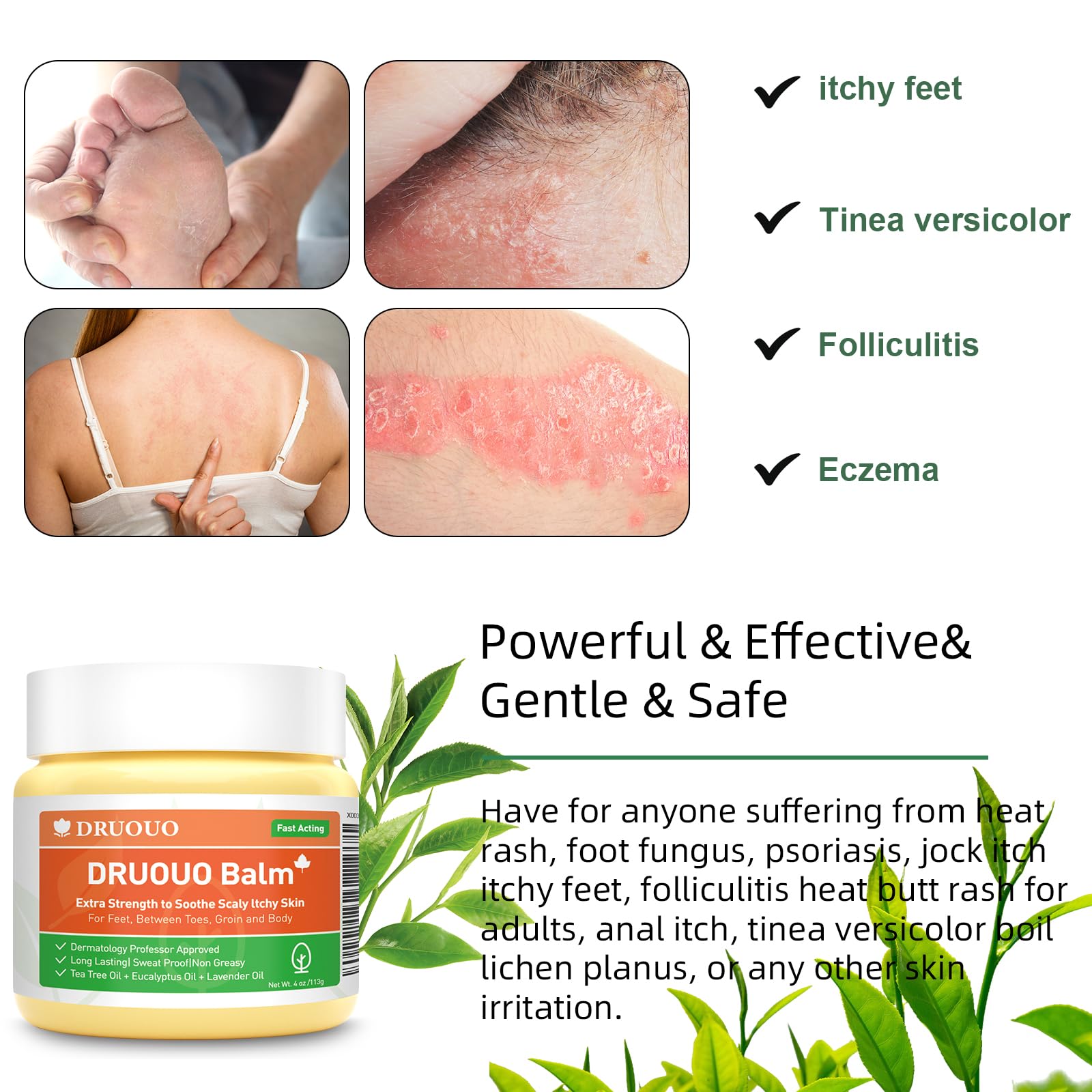 Draw Salve Eczema Cream Athlete's Itchy Foot Relief, Heat Rash, Anus Itch, Tinea Versicolor, Armpit, Lichen Planus, Cyst Removal Patch, Splinter Boil Ease, Ingrown Hair, Chigger, Carbuncle, Pilonidal