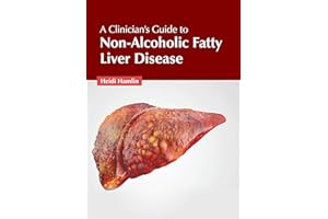 A Clinician's Guide to Non-Alcoholic Fatty Liver Disease