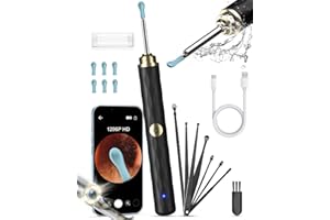 Kekoy Ear Wax Removal Camera, Ear Cleaner 1296P HD Camera, Ear Cleaning Kit with 8pcs Ear Set, Wireless WiFi Otoscope with 6 Lights, Rechargeable Earwax Removal Tool Kit for Adult & Kid(Black)