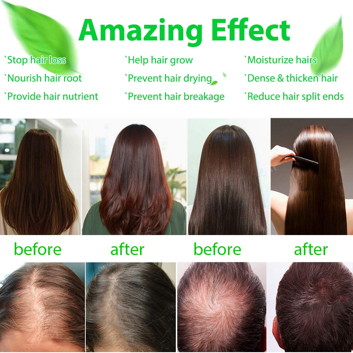 Healthy Hair Growth Essential Oil -Hair Serum Loss Treatment Thinning Therapy for Men Women Stronger Thicker Hair, Stimulate Hair Follicles to Stop Hair Loss, Regrow Hair, All Hair Type (50ml)