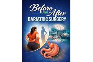 BEFORE AND AFTER BARIATRIC SURGERY