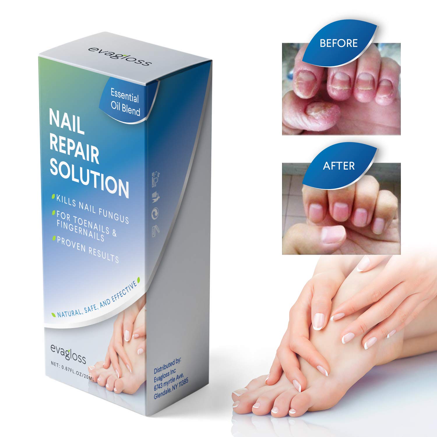 Fungus Stop, Natural Antifungal Nail Solution Kills Fungus On