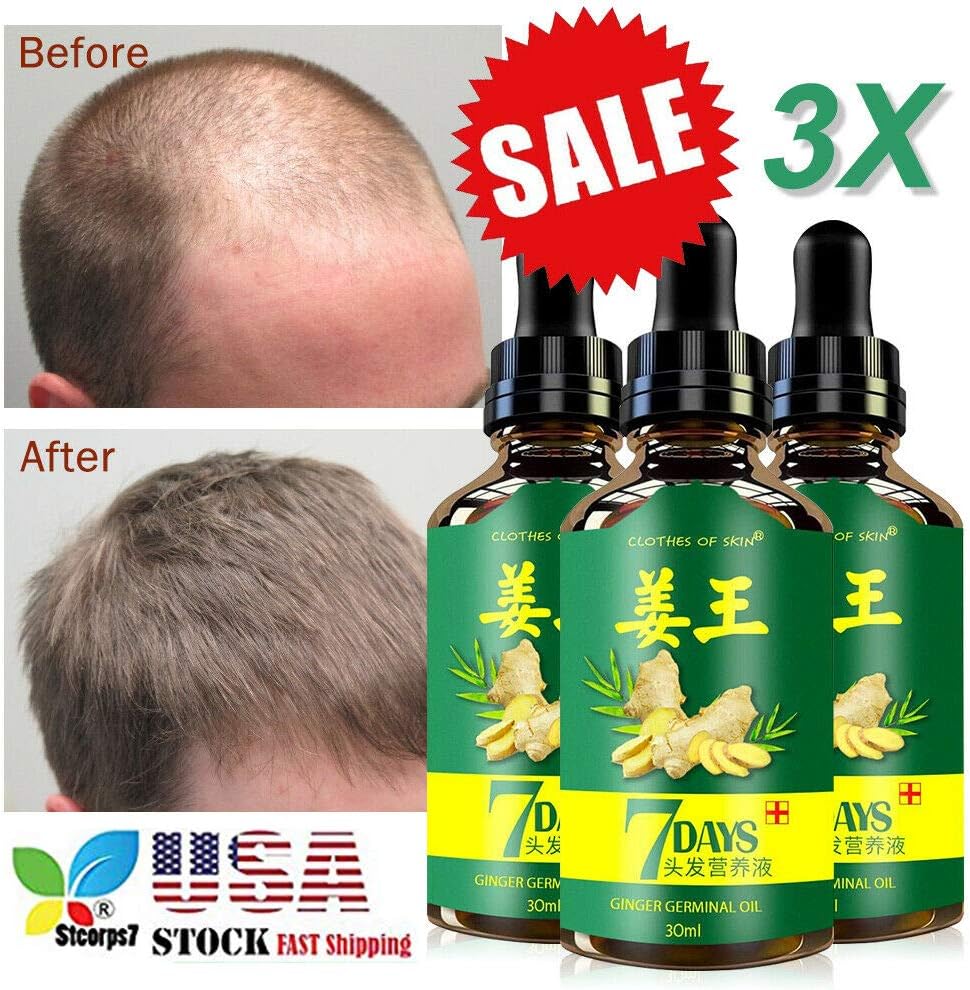 Hair Growth Products Ginger Oil, STCORPS7 Hair Growth Oil Serum Liquid Hair Loss for for Stronger, Thicker, Longer Hair Men & Women 30ml (3pcs.)