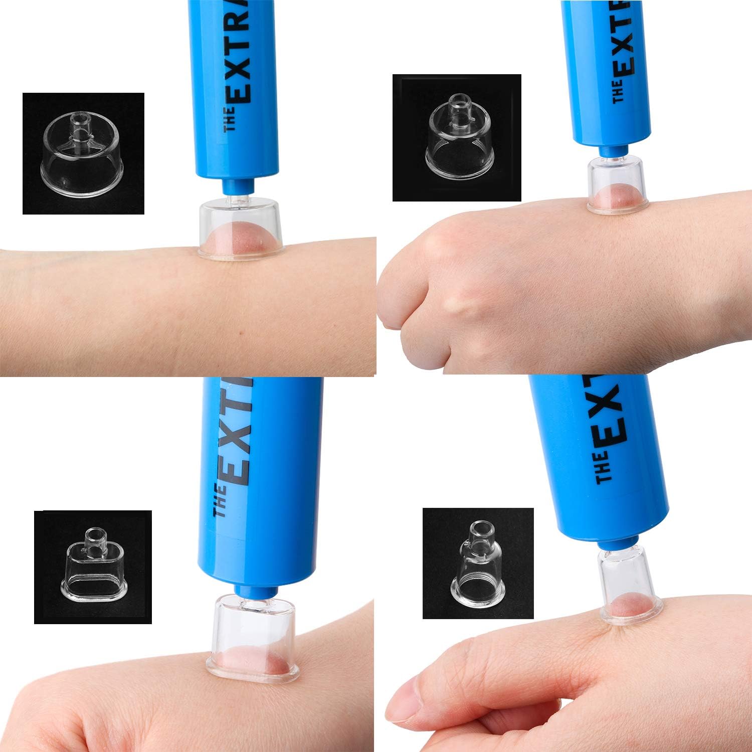 最も欲しかった ポイズンリムーバー 蚊 ポイズンリムーバー 蚊 効果